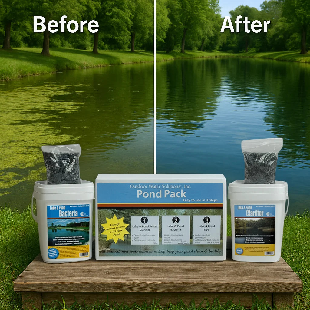Outdoor Water Solutions Pond Pack - Pond Treatment Bundle